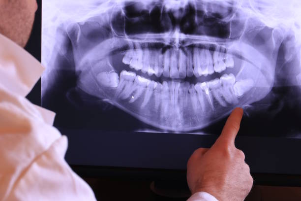 Best Emergency Root Canal Treatment in Williston Park, NY