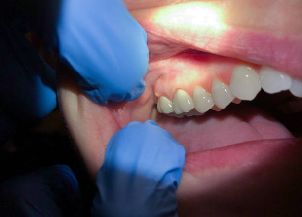 Best Emergency Dentist for Knocked-Out Tooth in Williston Park, NY